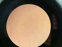 Mikroskopický vizuál mezenchymálnych kmeňových buniek izolovaných z moču (UdSCs)